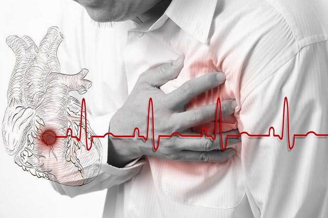 اعراض الجلطة القلبية أو ما يسمى إقفار القلب